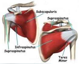 schouderimpingement