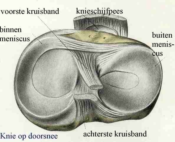 Total knee prothese